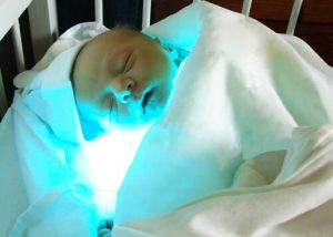 Hva er gulsott hos nyfødte og hvordan behandles det?