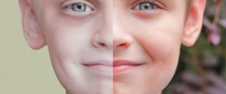 12 tegn på barneleukemi