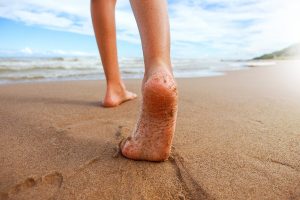 Hvordan korrigere hjulbenthet hos barn