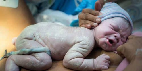 5 medisinske grunner til å sette i gang fødselen