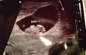 Ramzi-metoden for å finne ut hva babyens kjønn er