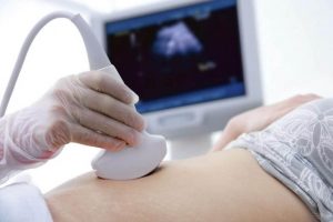 Hva er amniotisk båndsyndrom?