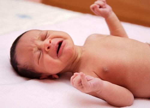 Medfødt torticollis hos spedbarn