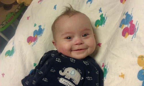 Torticollis hos babyer