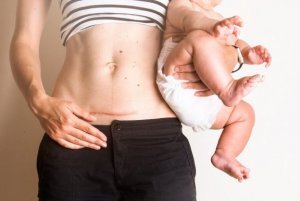 Noen tips for å ta vare på sting etter fødselen