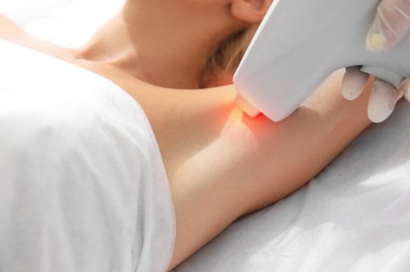 Kan man fjerne hår med laser når man er gravid?