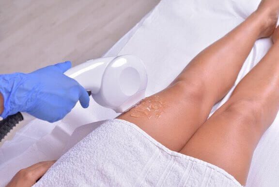 Hårfjerning med laser på beina