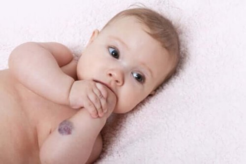 Medfødte hode- og ansiktsmisdannelser hos spedbarn