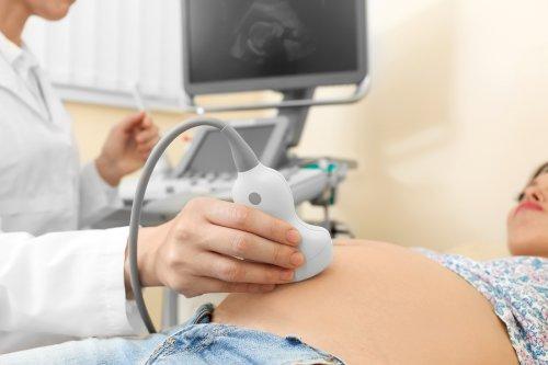 En gravid kvinne får en ultralyd.