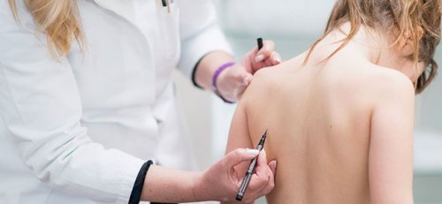 Skoliose hos barn: Alt du trenger å vite
