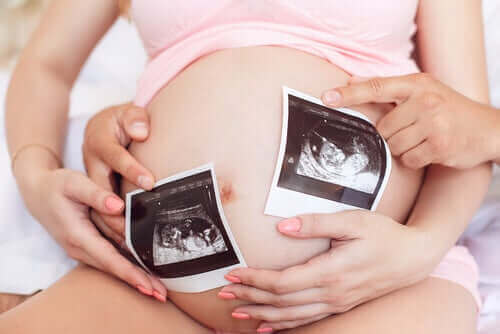 Gravid kvinne.