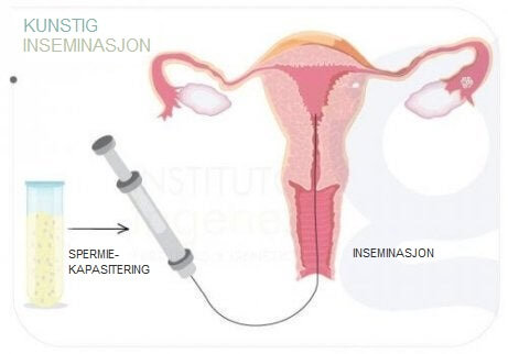 kunstig inseminasjon