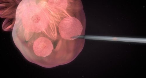 Kunstig inseminasjon: Hva det er og hvordan det fungerer