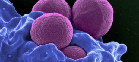 lavt antall nøytrofile granulocytte hos babyer