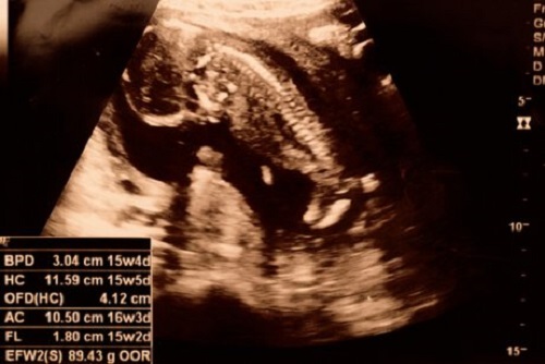 Ultralyd etter 15 uker.