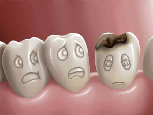 Hva er hull i tennene og hvordan kan de forhindres?