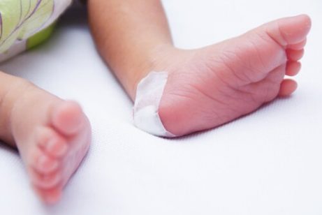 Pataus syndrom hos babyer