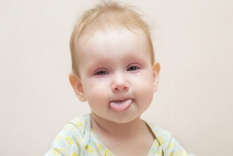 Konjunktivitt hos babyer: Årsaker, symptomer og behandling