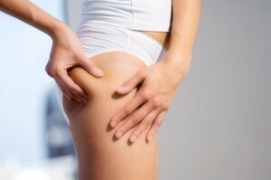 Hvordan bekjempe cellulitter etter graviditet