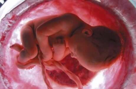 Bilde av en baby inne i livmoren