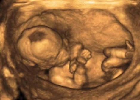 Et ultralydbilde av et foster