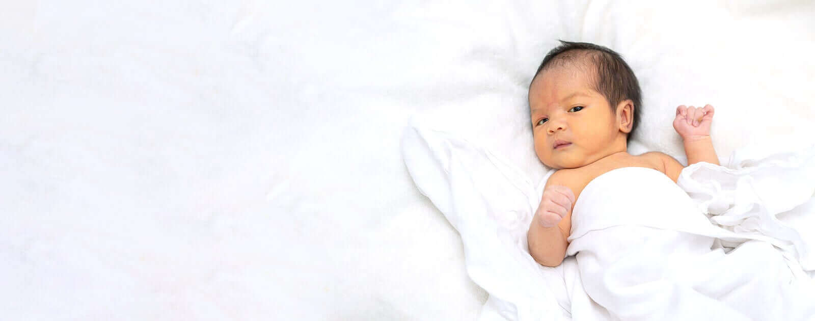 Hva er Kabuki syndrom?