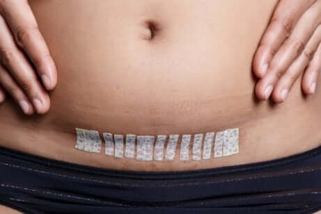 Hva du trenger å vite om hysterektomi