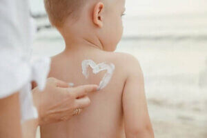 Hvordan beskytte huden til barn med kreft