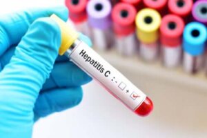 Hepatitt C under graviditet