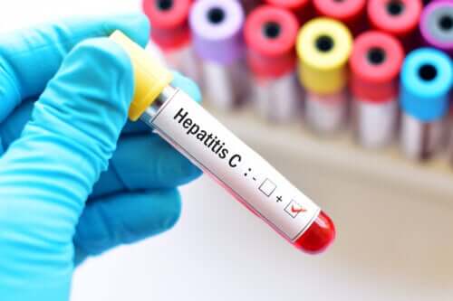 Hepatitt C under graviditet