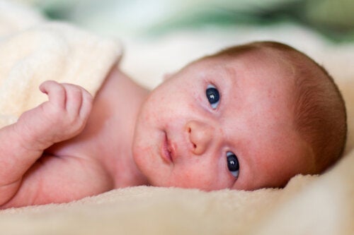 Hudutslett på babyer: Hva du bør vite