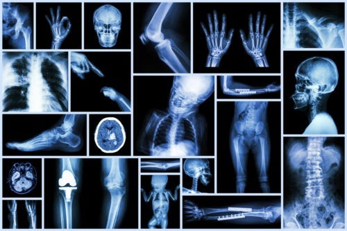 Røntgenstråler hos barn: Hva du trenger å vite
