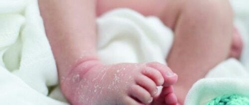 De 10 vanligste hudsykdommene hos babyer