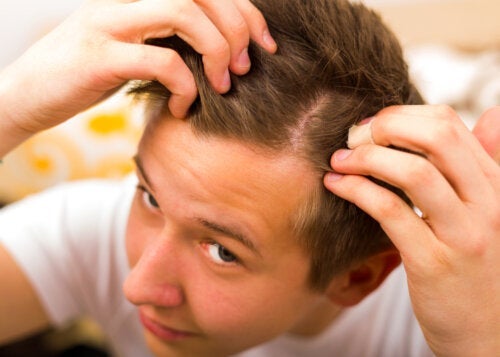 Hvordan forebygge juvenil alopecia