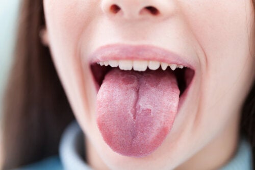 6 sykdommer hos barn som kan påvirke tungen