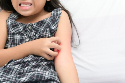 Dermatillomani hos barn: hva er det?