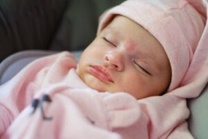 Englekyss og storkebitt: Flekker på babyens hud