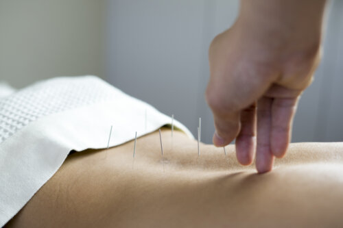 Fungerer akupunktur for å bli gravid?