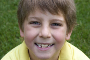 Barnet mitt sine nye tenner er gule, er det normalt?