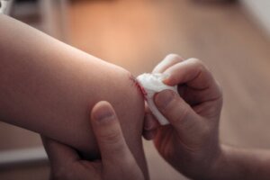 Abscesser hos barn: Symptomer, årsaker og behandlinger