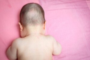 Hvorfor har babyen min skallede flekker?