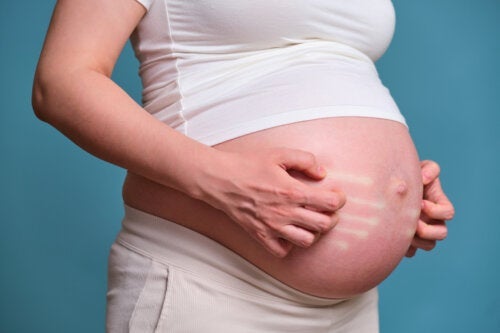 Hudallergier under graviditet