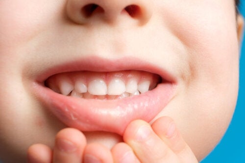 Kan tannemaljen vokse tilbake hos barn?