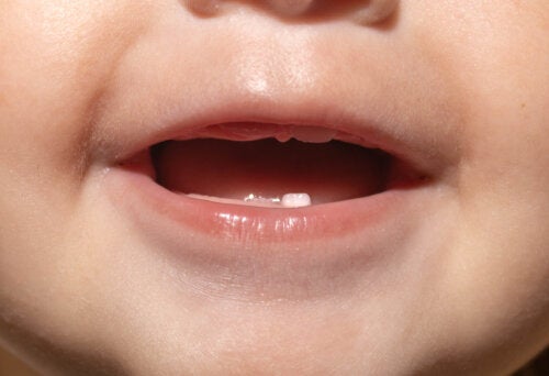 Ditt barns første tannlegetime: Hva kan du forvente?