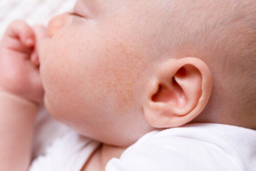 Kviser i ansiktet til en baby: Årsaker og behandling