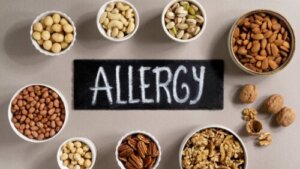 6 myter om matallergier hos barn