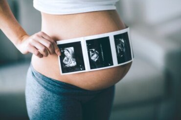 10 spørsmål om ultralyd under graviditet